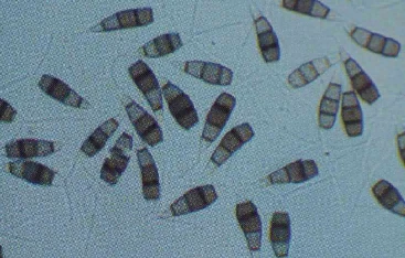 Conidia of the pathogen of grape branch blight Conidia of the pathogen of grape branch blight